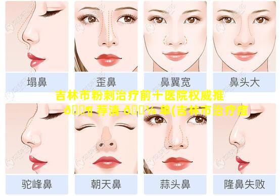 吉林市粉刺治疗前十医院权威推 🐶 荐清 🌼 单(吉林市治疗痘痘的医院哪个好)